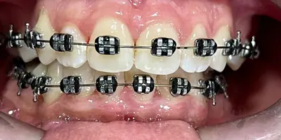 foto Ortodontia